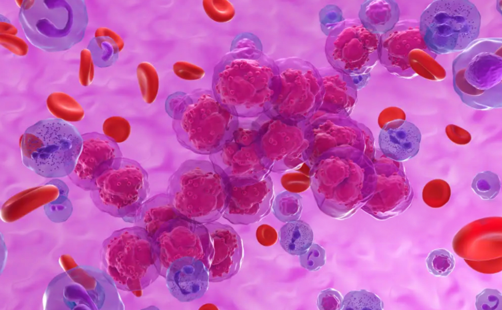 Leukemia_Blood_Cell