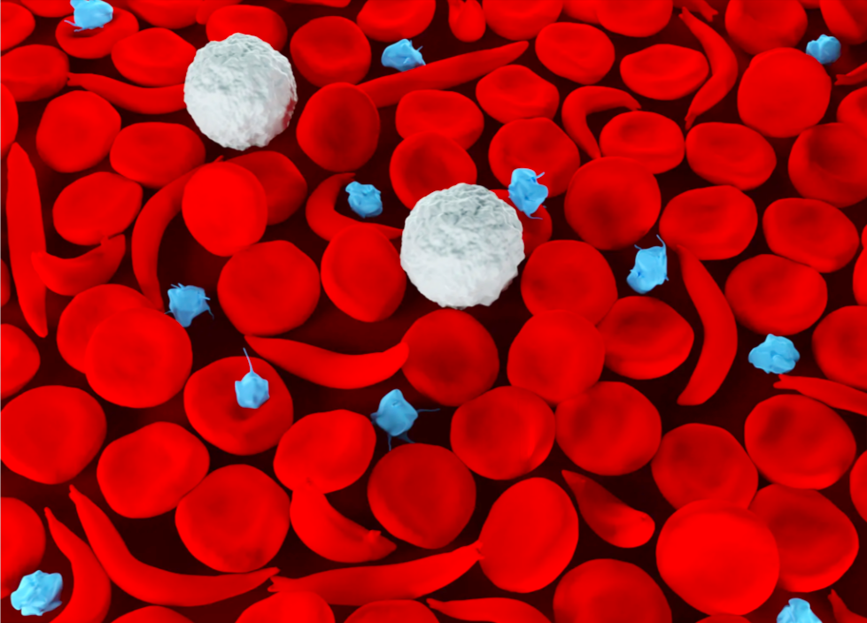 A photo illustration of red blood cells and other sickle-shaped cells depicting the sickle cell trait.